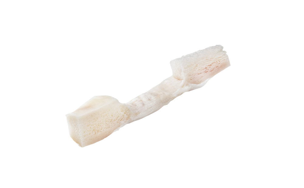 Patella Ligament Hemi Origin Biologics